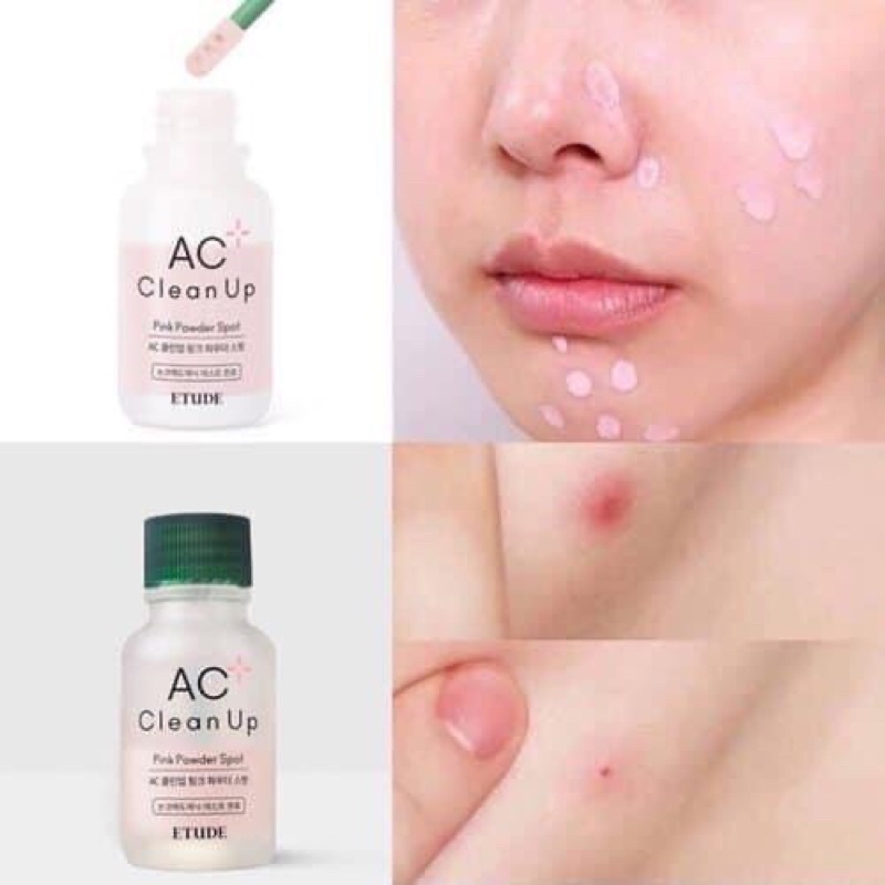 [Có bill]Chấm mụn Etude house AC clean up pink powder spot