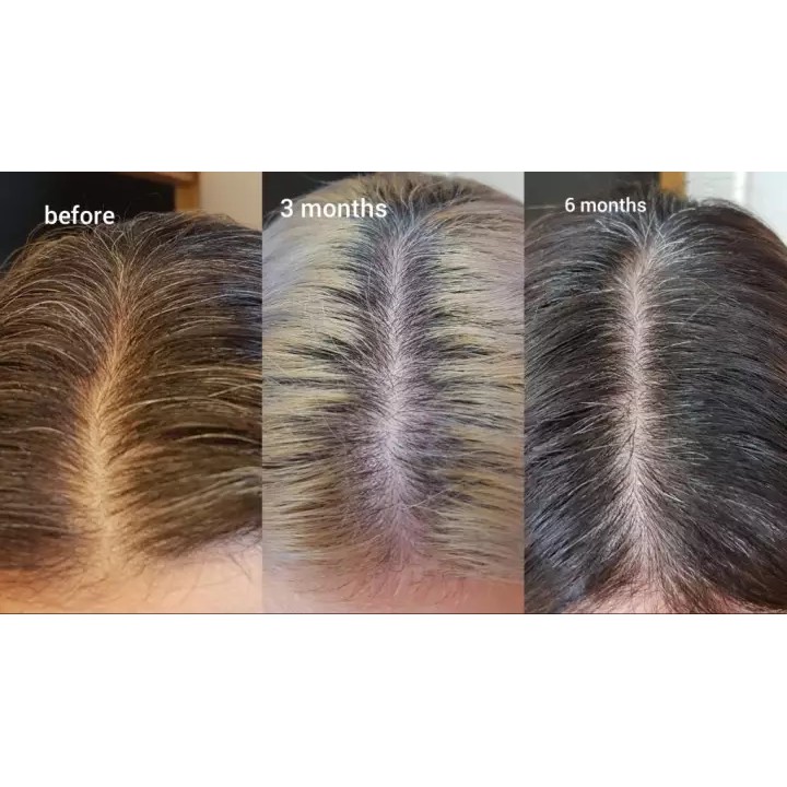 THE ORDINARY - Serum dưỡng mọc tóc  MULTI-PEPTIDE SERUM FOR HAIR DENSITY