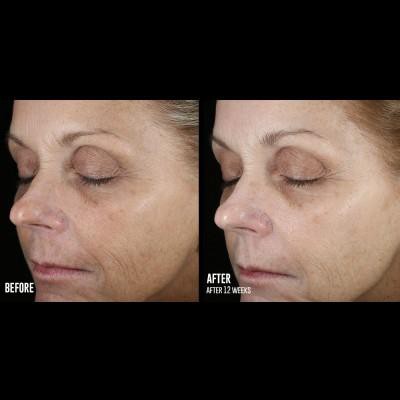 Skinbetter Even Tone Correcting Serum 50ml