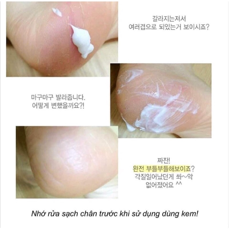 Kem Làm Mềm Giảm Nứt Gót Chân Hàn quốc Foot Care Cream