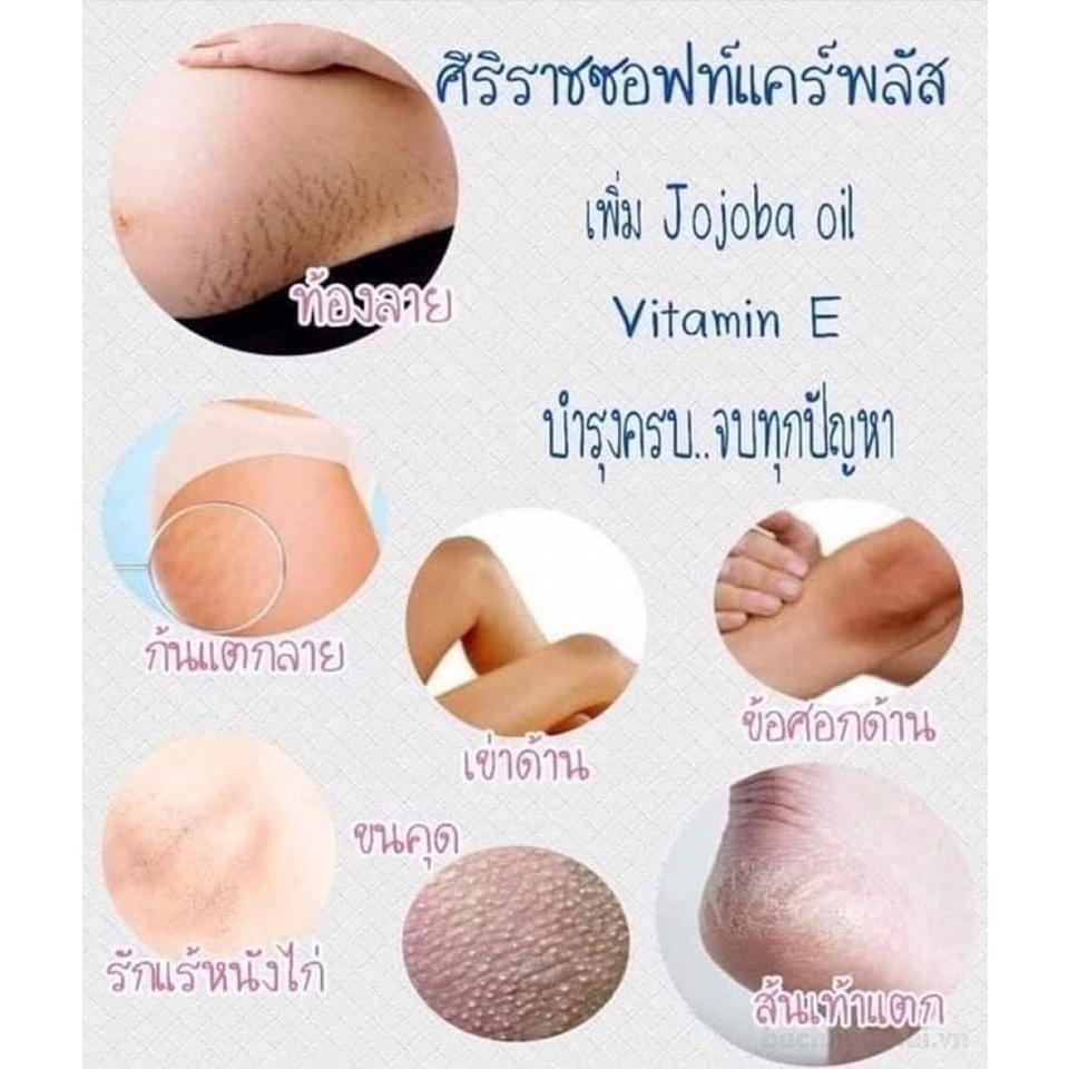 Kem bôi rạn da mờ sẹo Siriraj Soft Care Plus Thái Lan