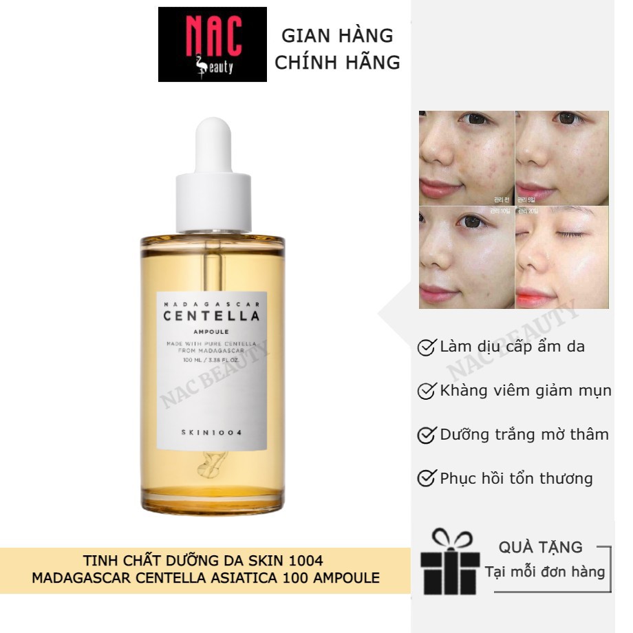 Tinh Chất Dưỡng Da Skin 1004 Madagascar Centella Asiatica 100 Ampoule - Ship hỏa tốc Thủ Đức