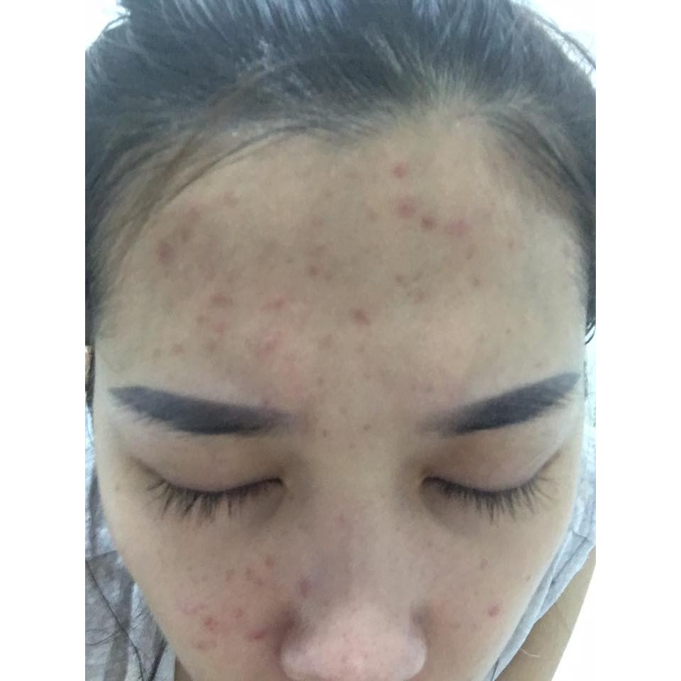 [MẪU MỚI] Blackmores Vitamin E Cream kem dưỡng da 50g | BigBuy360 - bigbuy360.vn