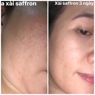 [QUÀ 🎁] Tinh Chất Sâm Đất-Saffron