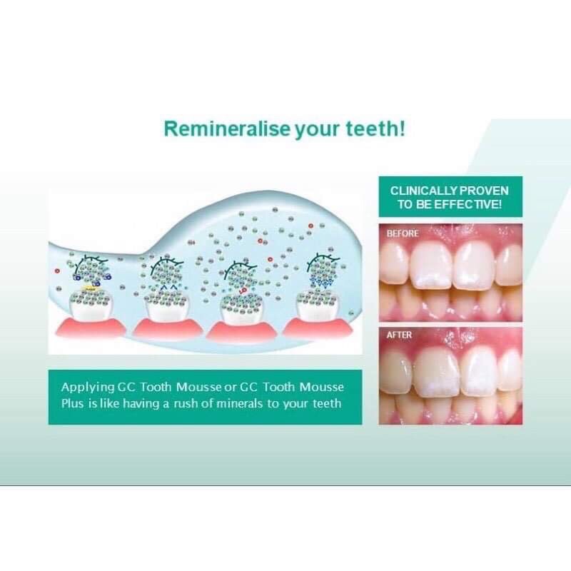 Gel bôi chăm sóc bảo vệ răng chống ê buốt GC Tooth Mouse 40g