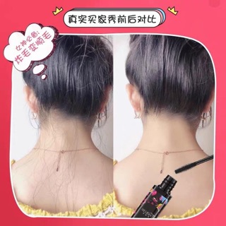 CHUỐT TÓC CON CHỐNG RỐI nội địa trung