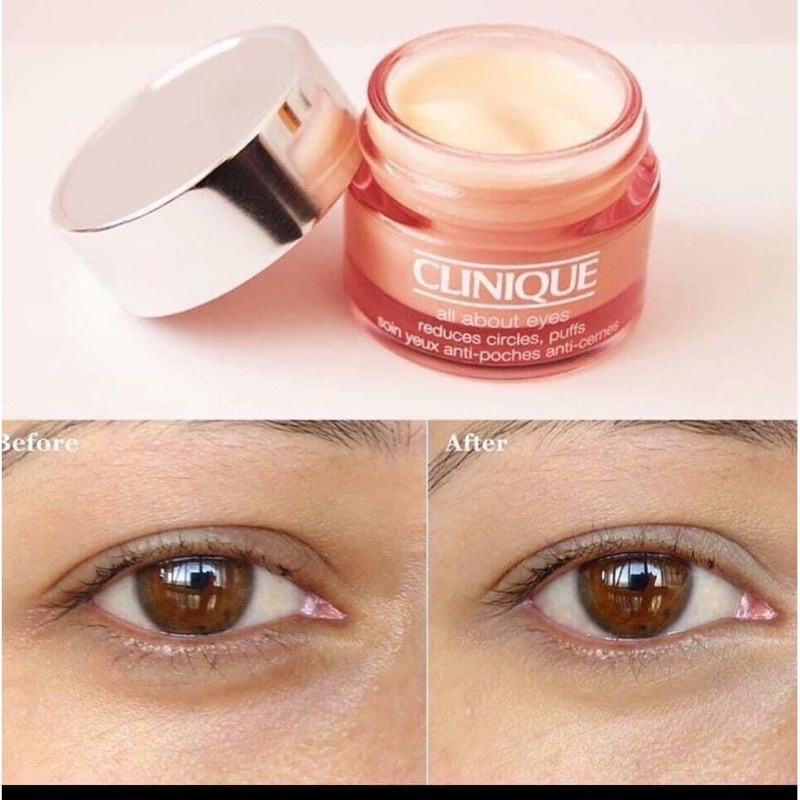 Kem Dưỡng Mắt Clinique All About Eyes 15ml