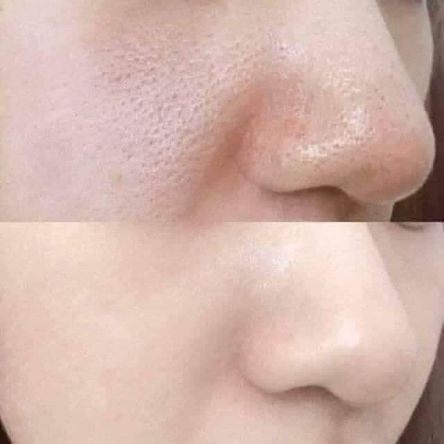 Tế bào gốc se khít lỗ chân lông pocia hiệu quả, dung tích lọ 10ml