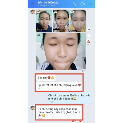 🌸SERUM HUNIE DƯỠNG DA SÁNG VÀ TỐI 🍓🐝 ‼️[ CAM KẾT CHÍNH HÃNG ] 𝐅𝐑𝐄𝐄𝐒𝐇𝐈𝐏 | BigBuy360 - bigbuy360.vn