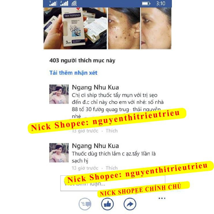 [Chính Hãng]GEL TẨY NỐT RUỒI, MỤN CƠM, MỤN CÓC, SẸO LỒI, THỊT THỪA - Dvelinil nhập khẩu Nga Hiệu quả Tốt | BigBuy360 - bigbuy360.vn