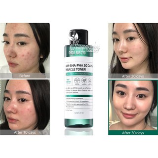 Toner đẩy mụn AHA-BHA-PHA 30DAYS TONER