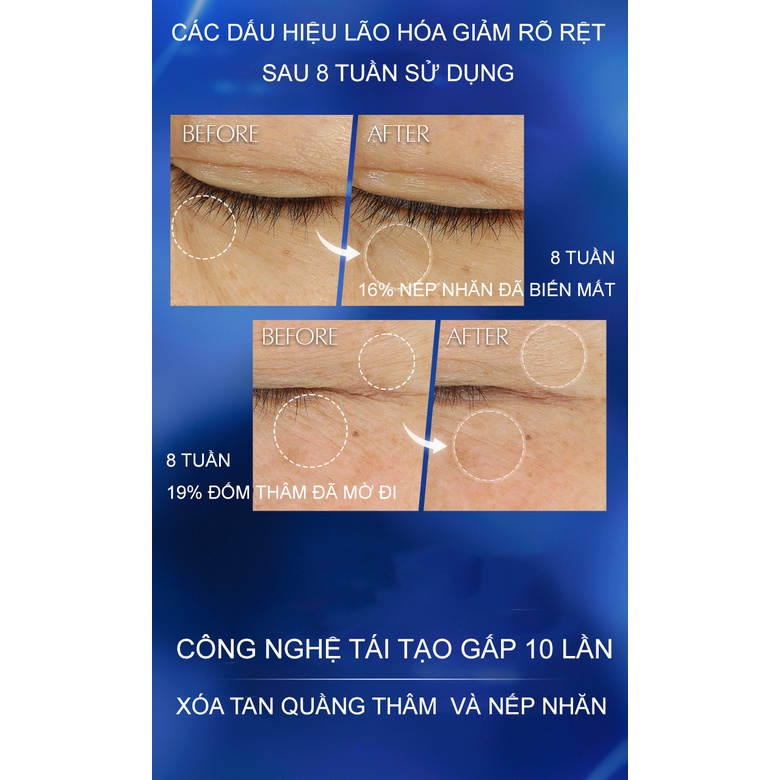 Kem Mắt Estee Lauder Advanced Night Repair Supercharged Complex Eye 3ml-5ml  Mini