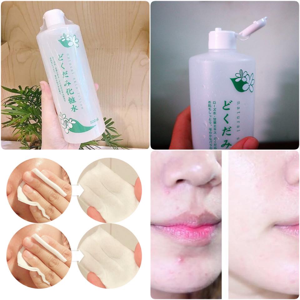 Toner Nước Hoa Hồng Diếp Cá Dokudami Natural Skin Lotion Nhật Bản | WebRaoVat - webraovat.net.vn