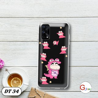 Ốp lưng dẻo cho Realme X7 Pro