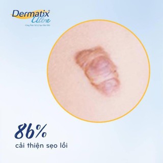 Dermatix Ultra Gel Làm Mờ Sẹo
