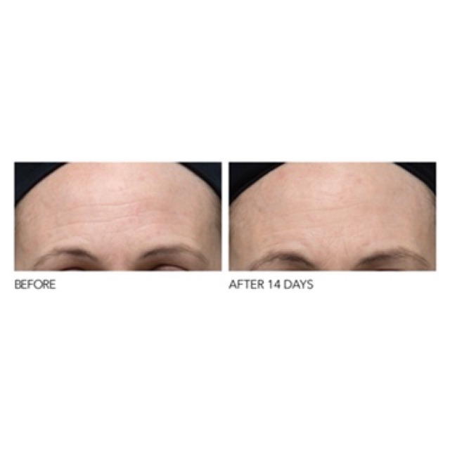 Bộ peel da Dr Dennis Gross Extra Strength Daily Peel