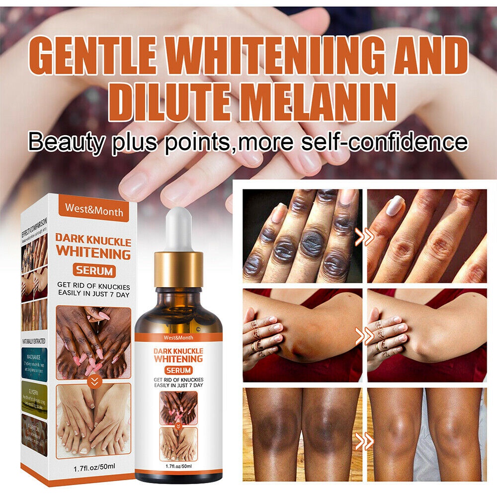 Serum Dưỡng Ẩm Làm Trắng Da Loại Bỏ Quầng Thâm Và Làm Sáng Da