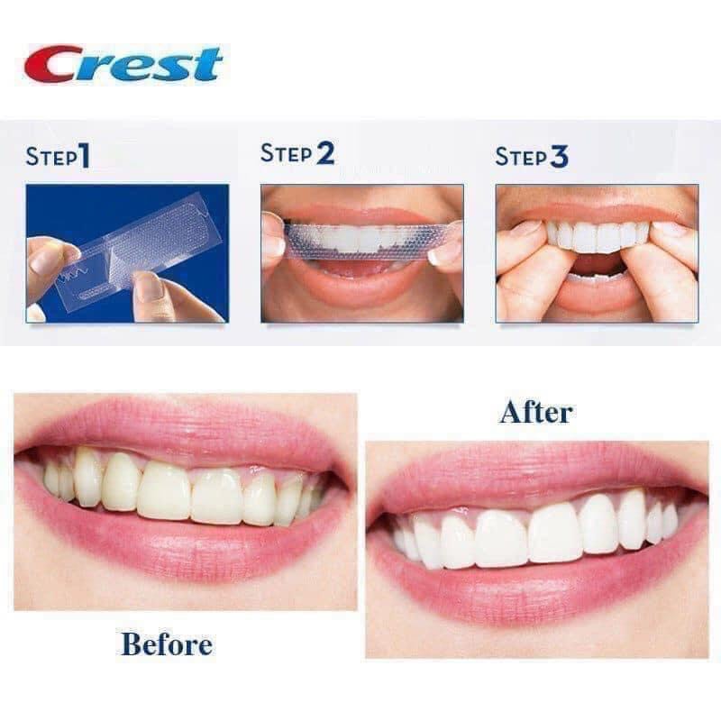 Miếng dán trắng răng Crest 3d Whitestrips Dental  Whitening Kit - Mỹ