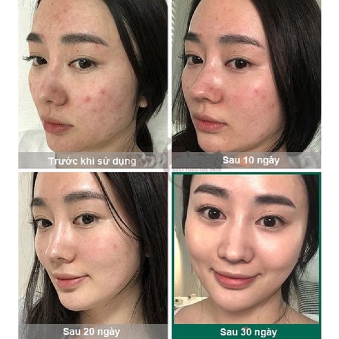 Kem Dưỡng Some By Mi AHA-BHA-PHA 30 Days Miracle Cream 60g