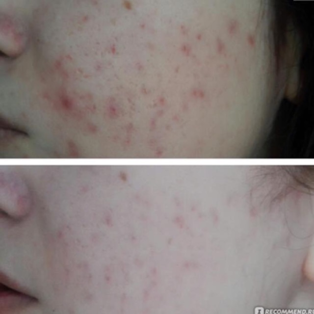 [Mã COS1904 giảm 8% đơn 300K] Serum Siberica dưỡng trắng da mờ thâm sạm, se khít chân lông | BigBuy360 - bigbuy360.vn