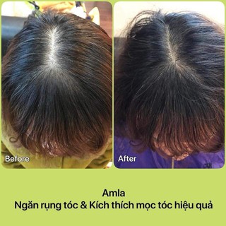 Cặp dầu gội - xả Amla