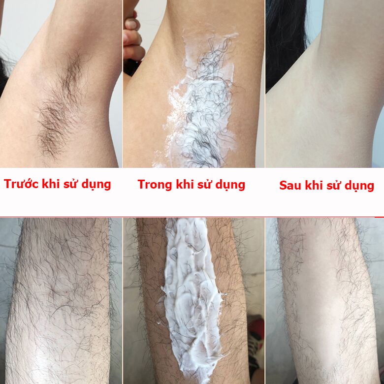 Kem tẩy lông tẩy lông vùng kín tẩy lông vùng kín không đau tẩy lông vĩnh viễn tẩy lông an toàn