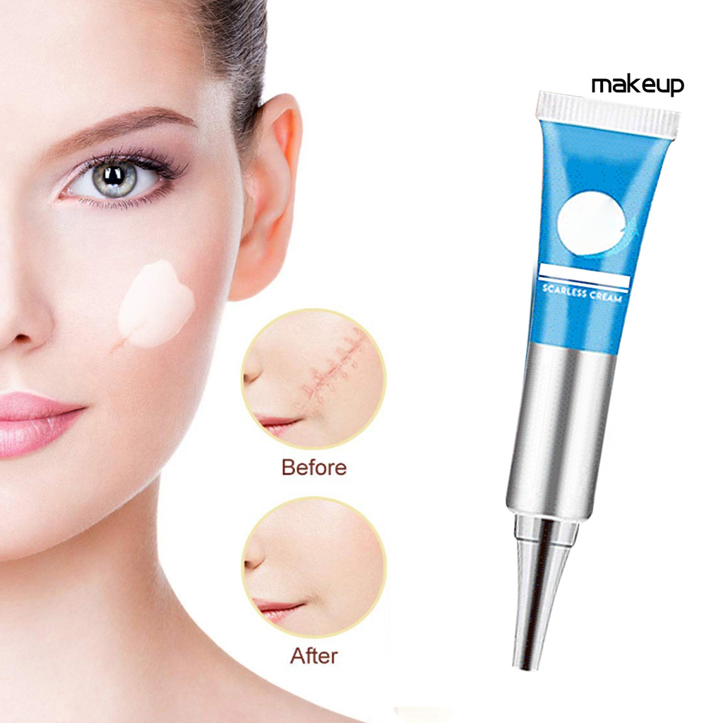 MK- Blackhead Acne Stretch Marks Scar Removal Cream Repair Gel Ointment Skin Care
