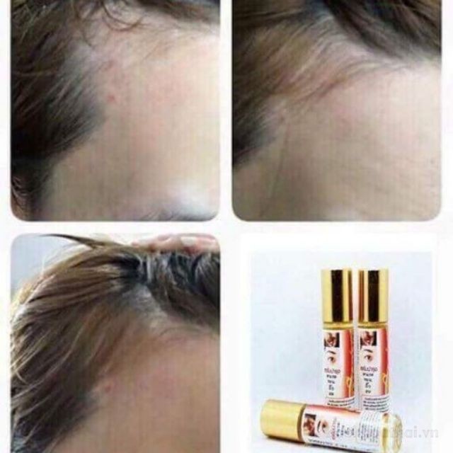 Serum ƙích mọc lông mi, châŋ mày, râu, ṫóc Genive Thái Lan