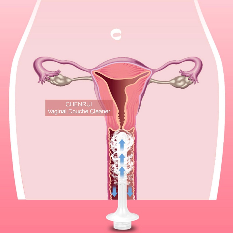 Youyo Dụng Cụ Làm Sạch Vết Chai Hậu Mông Làm Sạch Vết Bẩn An Toàn Cho Sức Khỏe