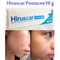 Hiruscar Gel Chuyên Dành Cho Sẹo Mụn và Thâm Mụn Hiruscar Post Acnes (5g,10g)