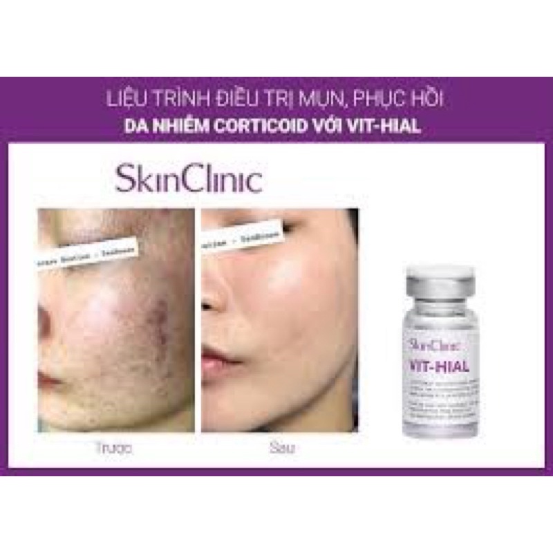 VIT-HIAL-sản phẩm chống lão hóa, phục hồi và tái tạo da cực kỳ hiệu quả 1 hộp 5 lọ