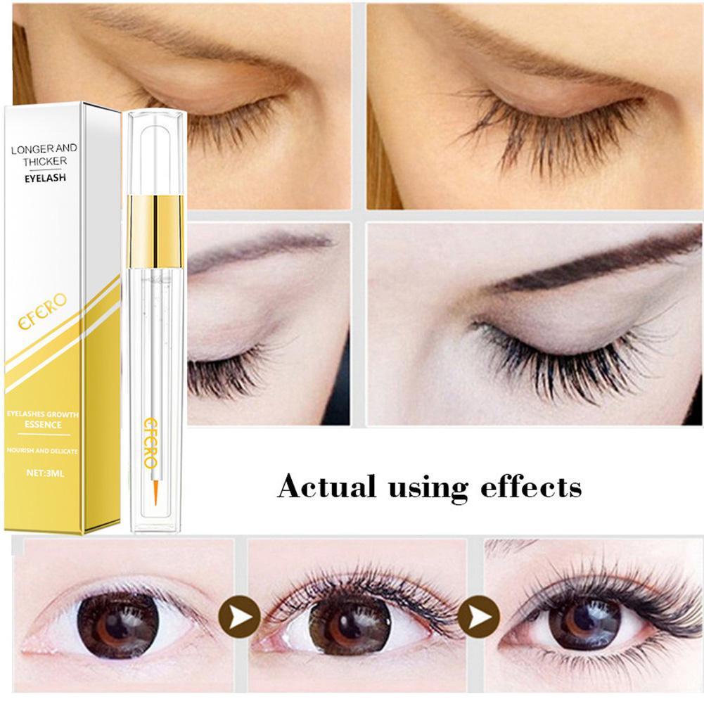 Serum kích thích mọc lông mi 3ml M3X5 I2L1
 | BigBuy360 - bigbuy360.vn