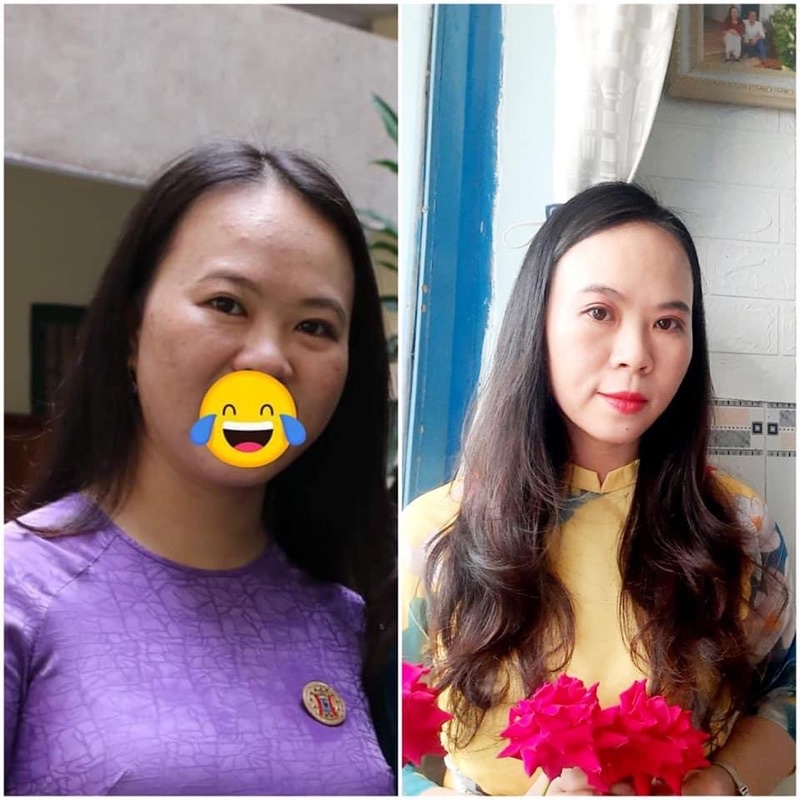 Serum mụn Nhà Bơ