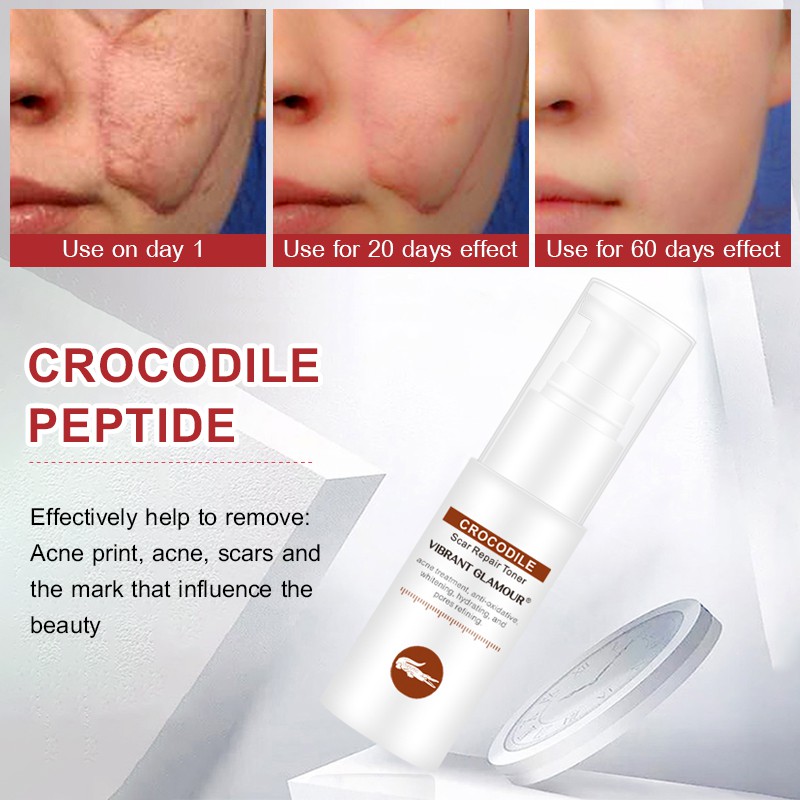 Toner VIBRANT GLAMOUR hỗ trợ giảm sẹo do mụn giảm vết rạn da cấp ẩm không gây nhờn dính phù hợp với mọi loại da 40ml | BigBuy360 - bigbuy360.vn