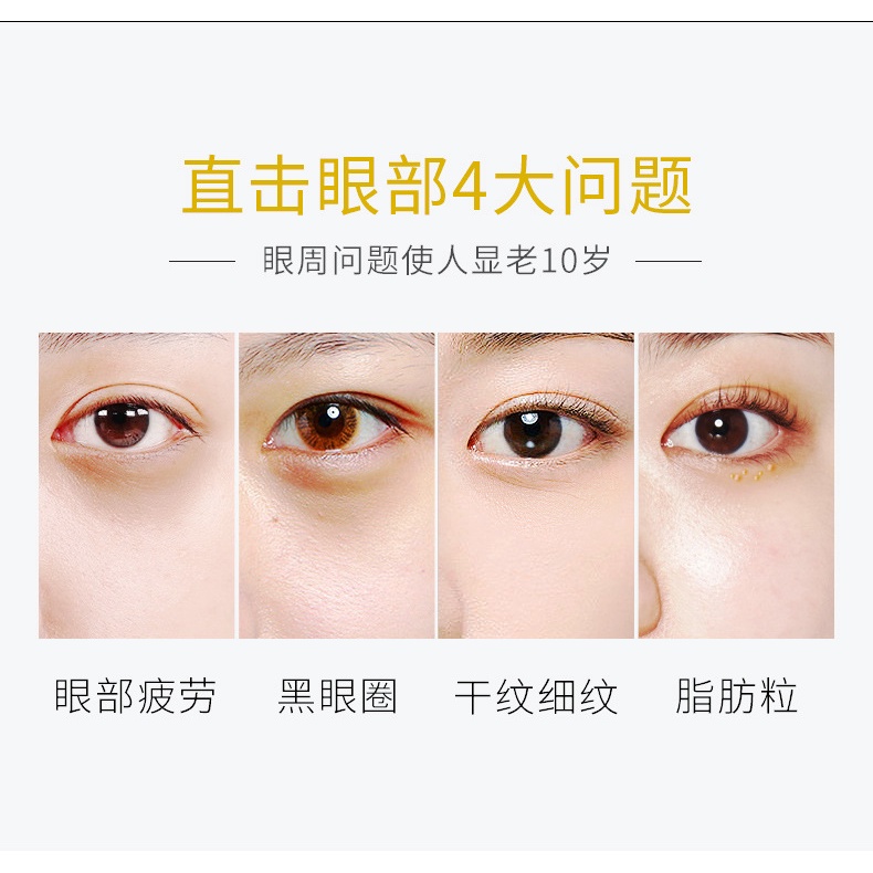 Mặt nạ Dưỡng mắt Bioaqua Mặt nạ Giảm thâm mắt Dưỡng ẩm mắt Luxuka MNB17