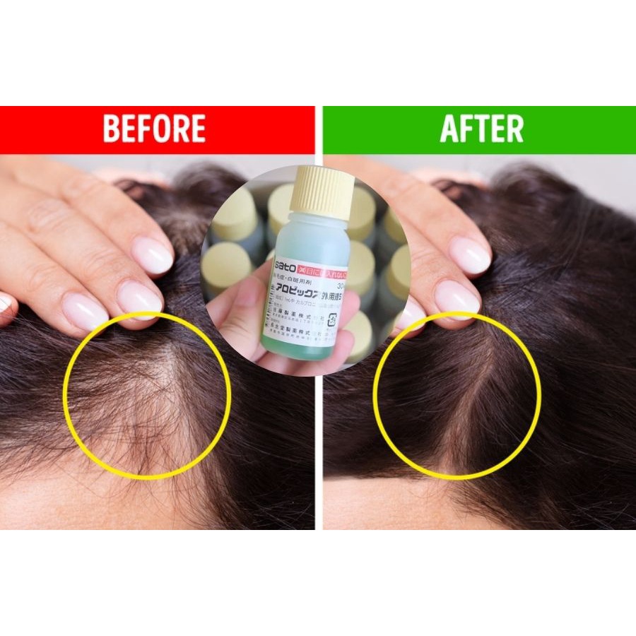 Tinh chất bôi kích thích mọc tóc Sato Arovics Solutions thảo dược 30ml okami