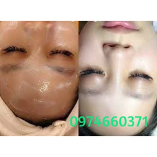 Ủ trắng nhau thai cừu, ủ trắng, ủ trắng mặt