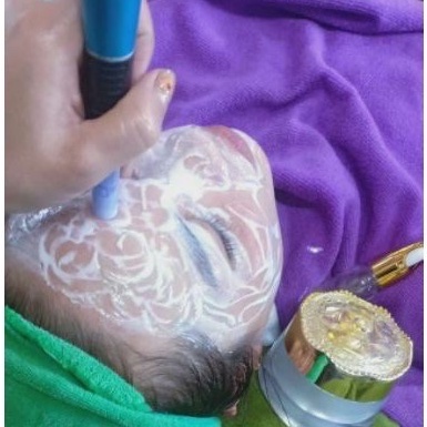 CẤY TRẮNG LỤA HÀNG CHUẨN CẤY NANO COLLAGEN TRẮNG SÁNG TẠI NHÀ VÀ SPA