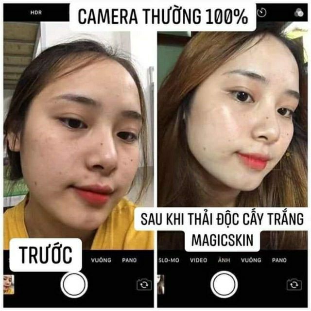 Ủ YẾN THẢI ĐỘC VÀ TRUYỀN TRẮNG DA