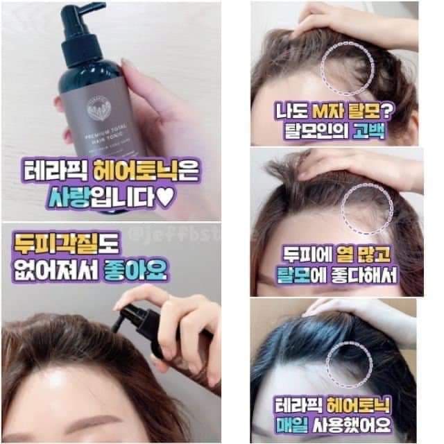 Tinh Dầu Kích Thích Mọc Tóc Terapic Premium Total Hair Tonic 160ml Từ Nhiên Thiên, An Toàn Cho Sức Khỏe