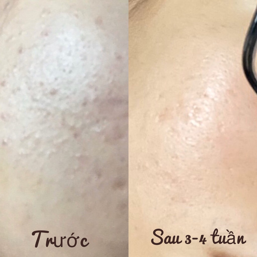 Bộ Đôi Làm Đều Màu Da & Trắng Sáng Zakka Naturals | BigBuy360 - bigbuy360.vn