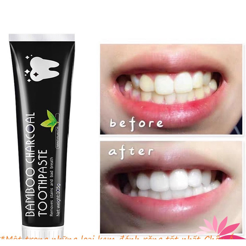 Kem đánh răng than hoạt tính Bamboo Charcoal Toothpaste 105g giúp răng tráng sáng tự nhiên