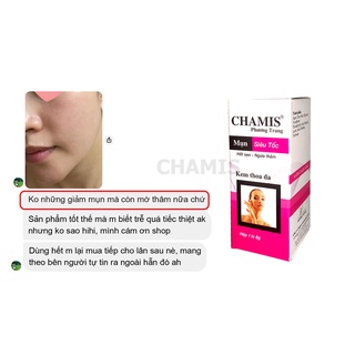 Kem giảm mụn siêu tốc, mờ thâm sẹo CHAMIS