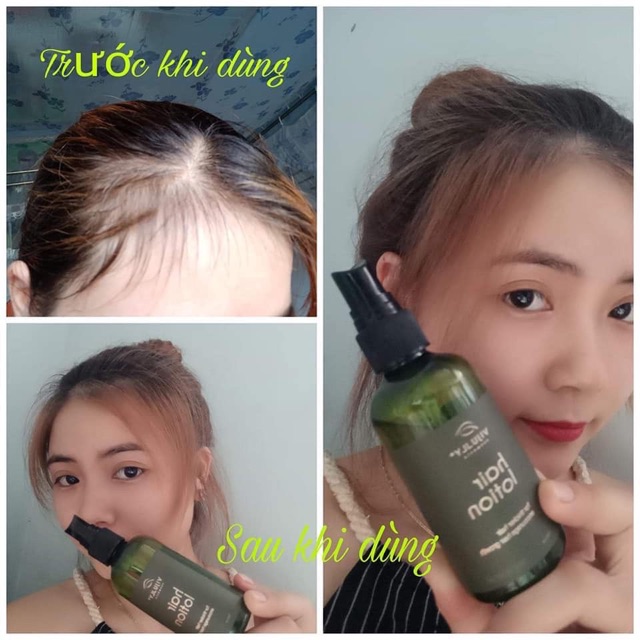 TINH DẦU BƯỞI VI JULLY CHÍNH HÃNG, HAIR LOTION KÍCH THÍCH MỌC TÓC,TRỊ RỤNG TÓC,TRỊ HÓI, TINH DẦU VIJULLY,tinh dầu vijuly