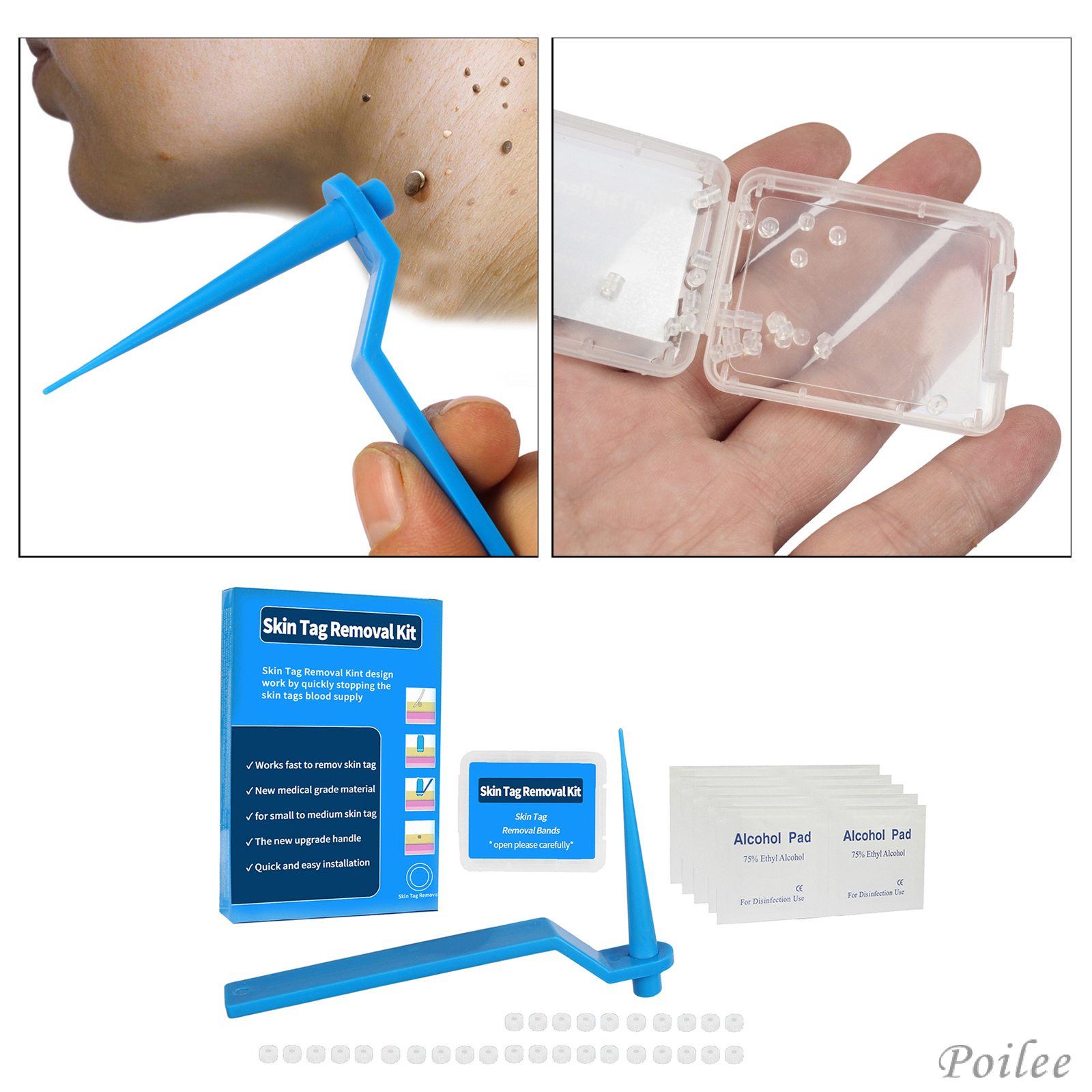 Skin Tag Kill Skin Mole Wart Remover Band, Skin Tag Removal Kit, with Cleansing Pads, Adult Mole Wart Face Care Tool