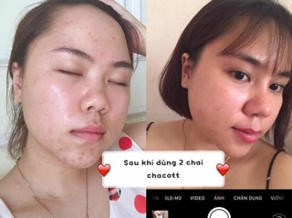 Tẩy trang Chacott