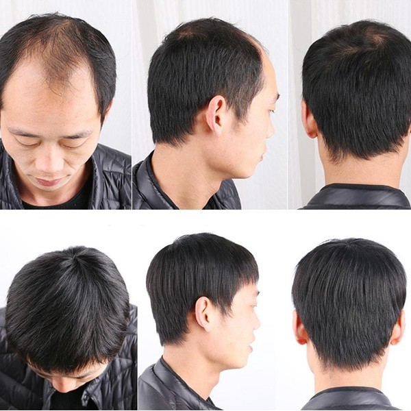 Đầu tóc giả thay thế dạng ngắn thoáng khí cho nam