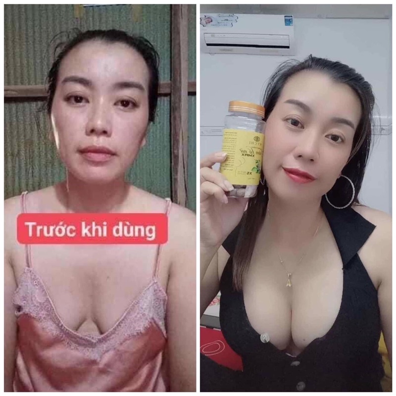 Kẹo mầm sâm tố nữ xmax Mychi hộp 150 viên