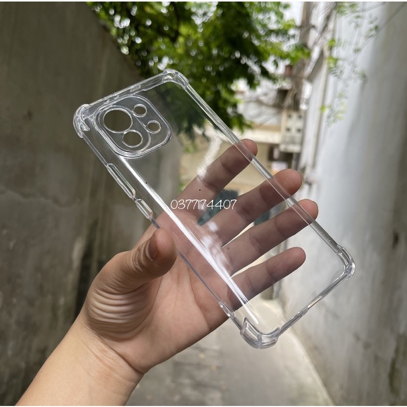 Ốp lưng Xiaomi Mi 11 Silicon bo 4 cạnh chống sốc bảo vệ máy trong suốt