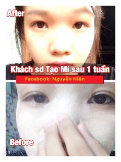 [ FREE SHIP ] Tinh chất tạo mắt 2 mí Pháp